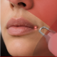 Q-Switch Nd:YAG Depigmentation